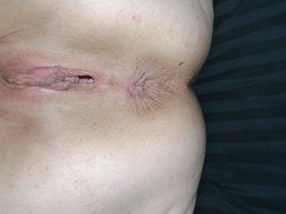 25P Play with all my holes