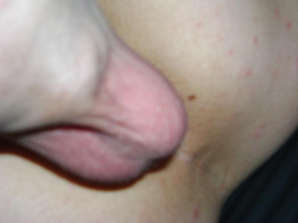 25P Play with all my holes