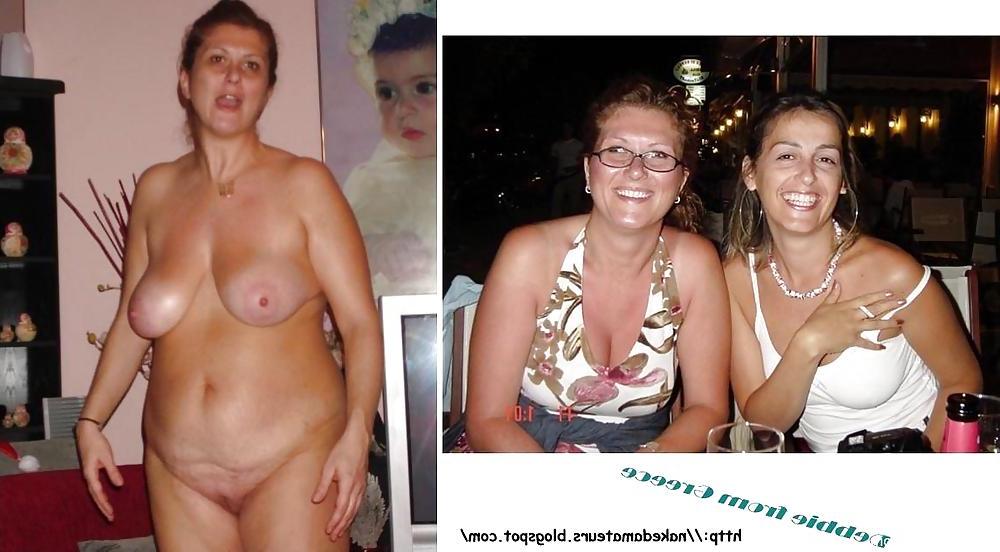 16P Amateur dressed undressed set 2