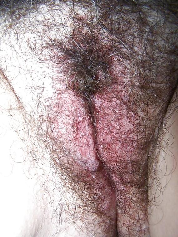 25P Mature big hairy cunts! Amateur Mixed!