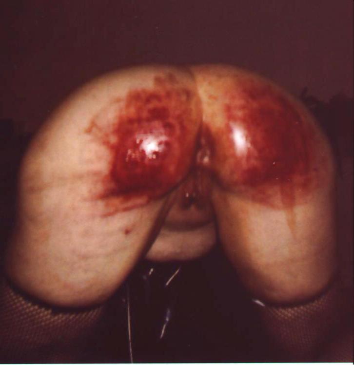 25P Amateur BDSM 5