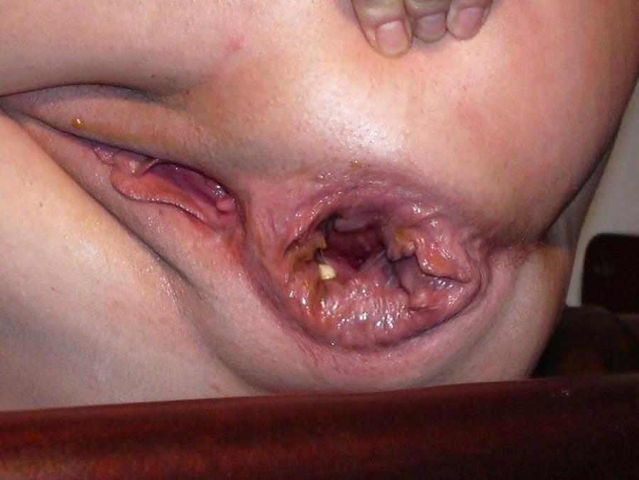 25P Amateur Mature Housewife flashing their loose pussy.