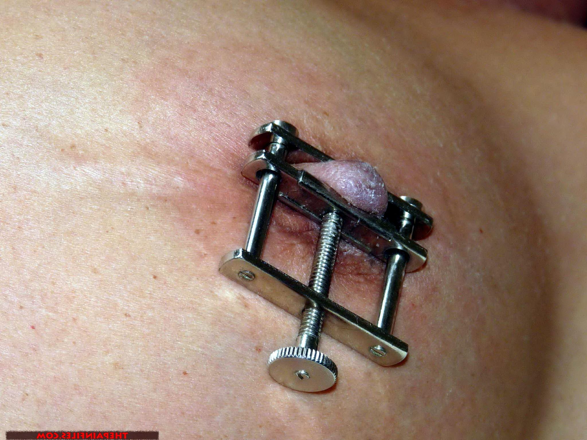 16P Belgian needle bdsm and extreme female torture of amateur slave girl Melissa