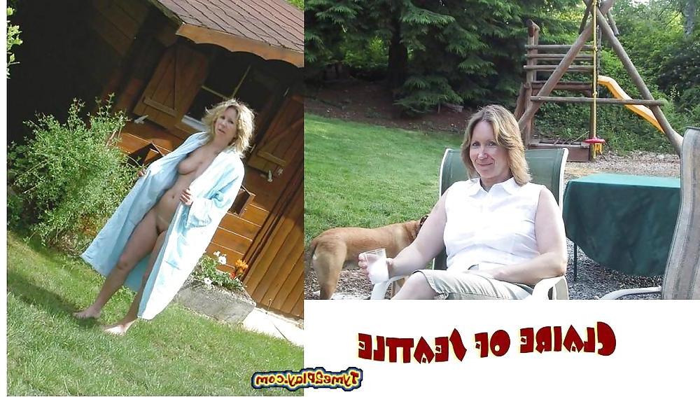 25P Amateur dressed  undressed  set 1