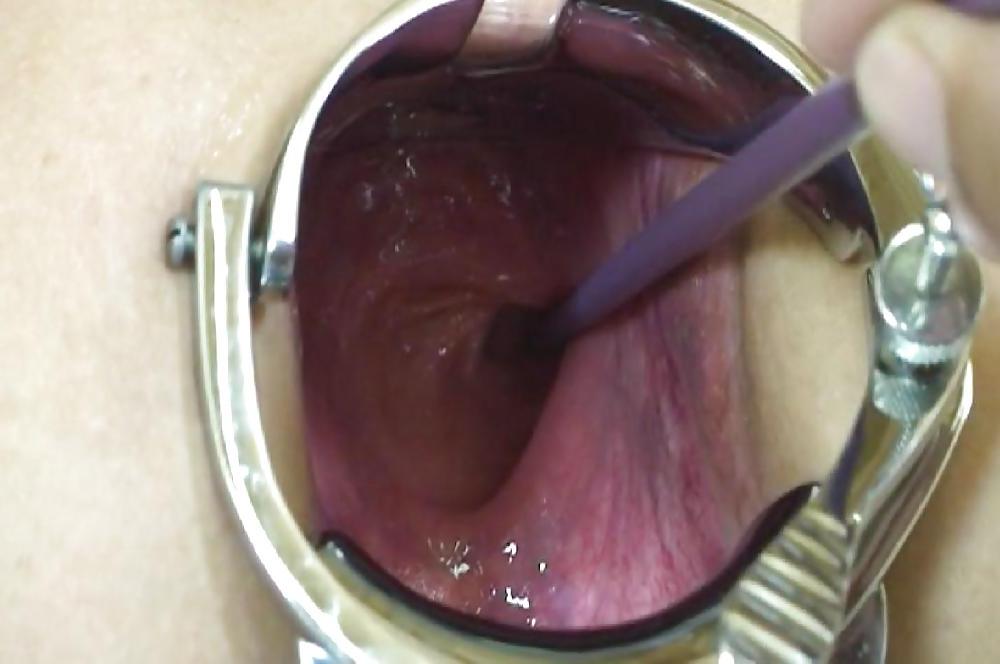 19P Pictures of incredible anal insertions by M.D.F.