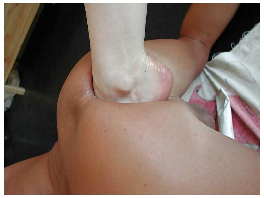 25P Anal Insertion