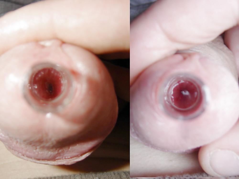 25P Bdsm extreme insertions urethral anal femdom