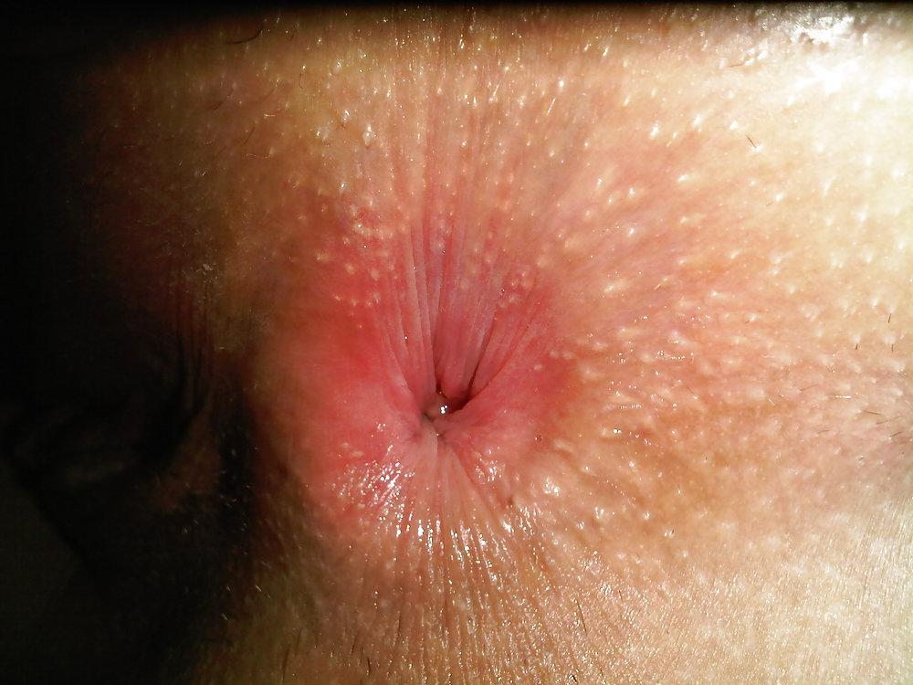 15P Gewuenschte Anal fickt bilder meiner Frau