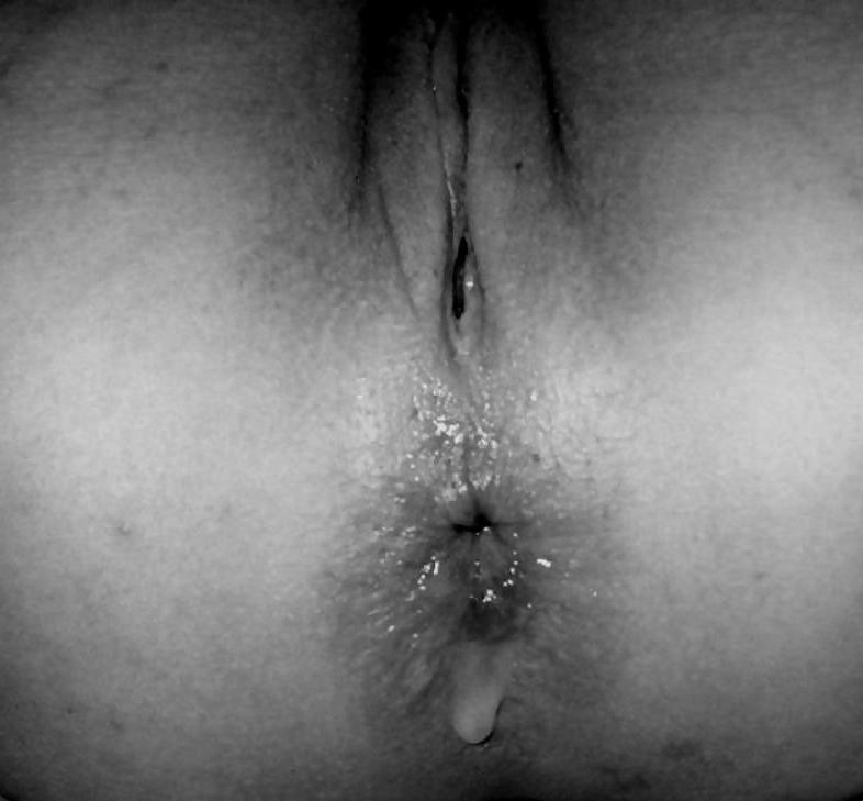 15P Anal love