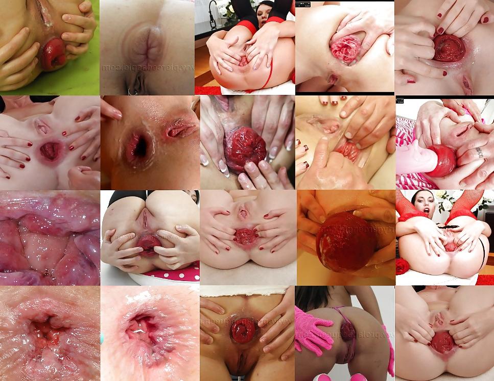 4P Compilation Anal