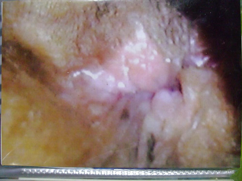 22P Anal milf