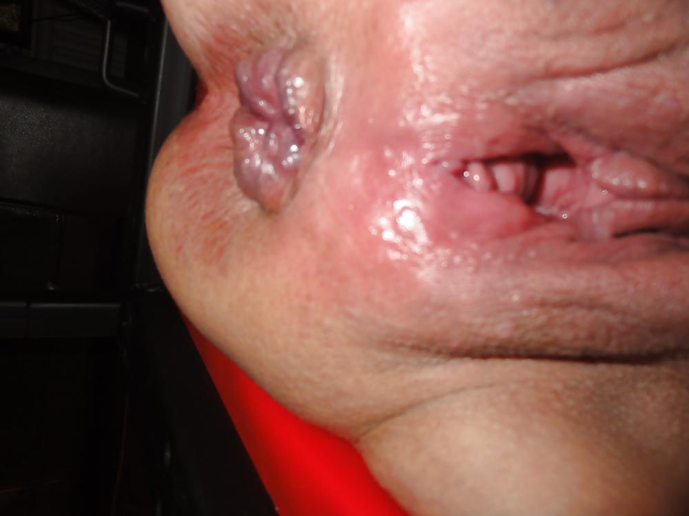 21P Anal Session 8.3.13