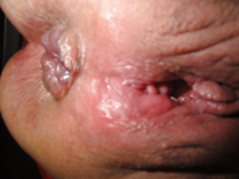 21P Anal Session 8.3.13