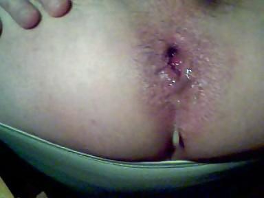 5P Anal squirt