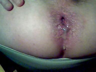 5P Anal squirt