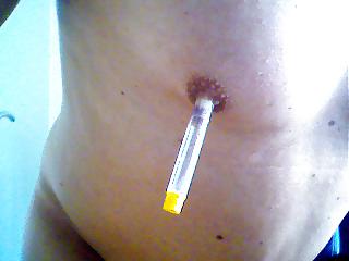 15P Anal