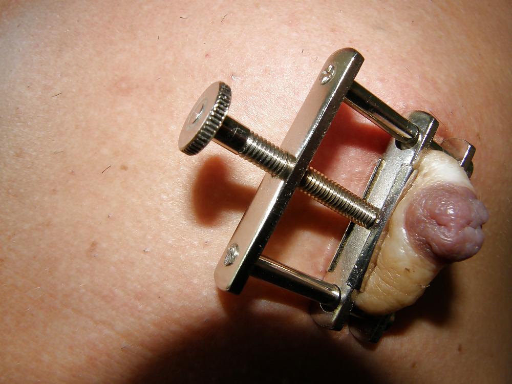 15P Anal