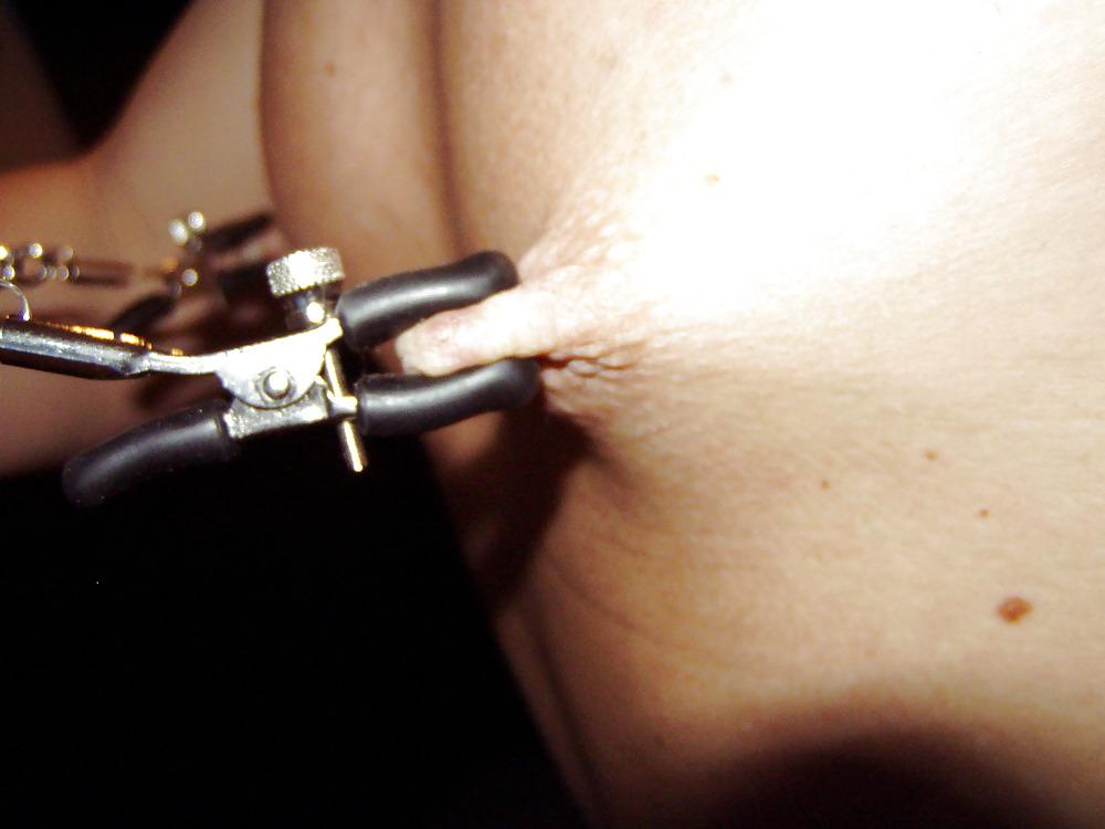 15P Anal