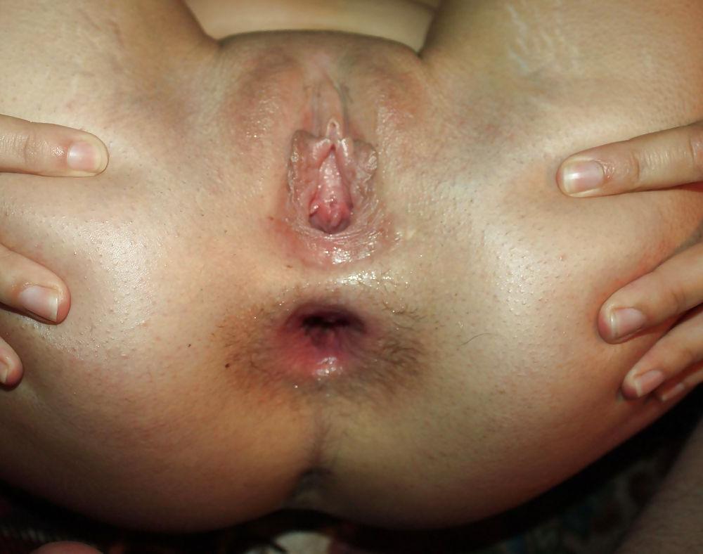 11P Anal fuck gape ass wife
