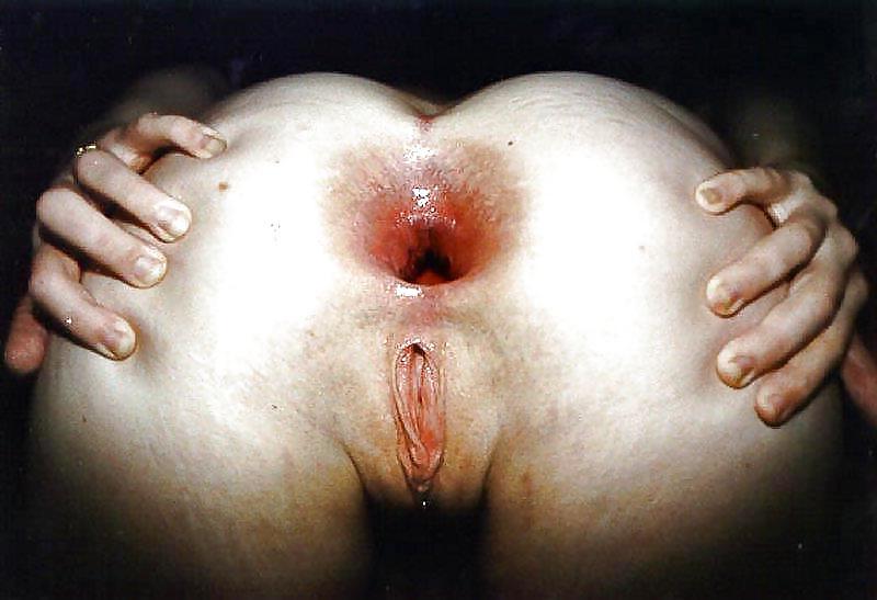 25P Anal gape 29