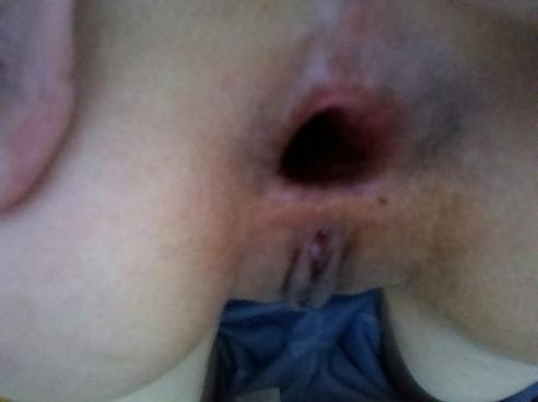 14P Anal outdoor