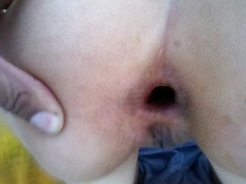 14P Anal outdoor