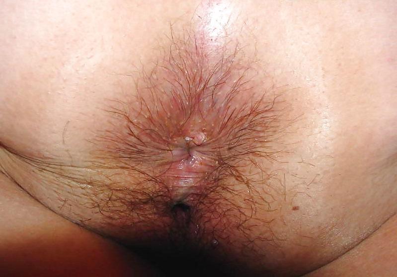 21P Natural Amateur Asshole Closeups