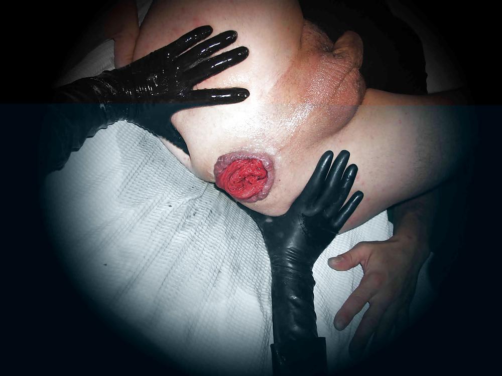25P Anal fisting 1