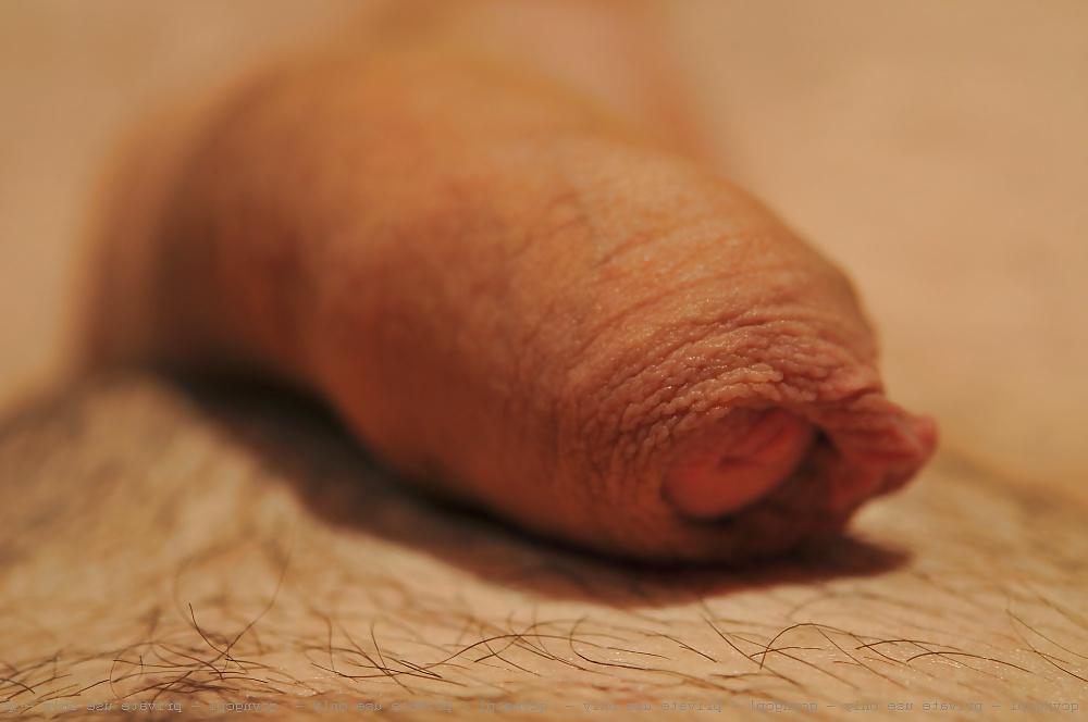 15P Foreskin Amateur