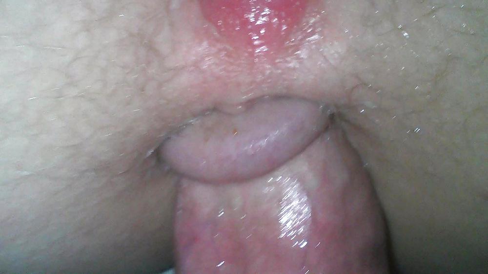 25P Amateur anal homemade