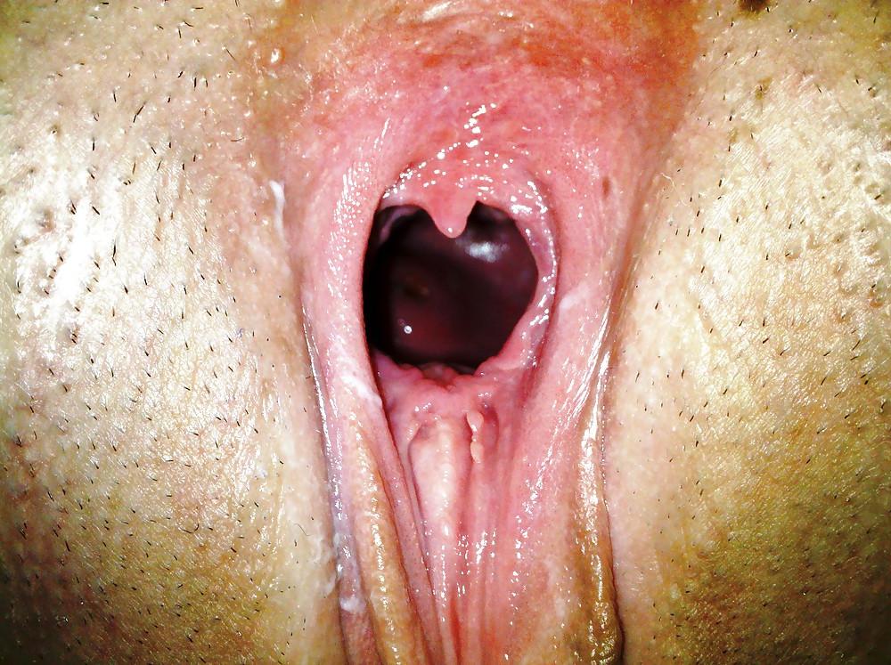 17P Pussy & Anal Gaping