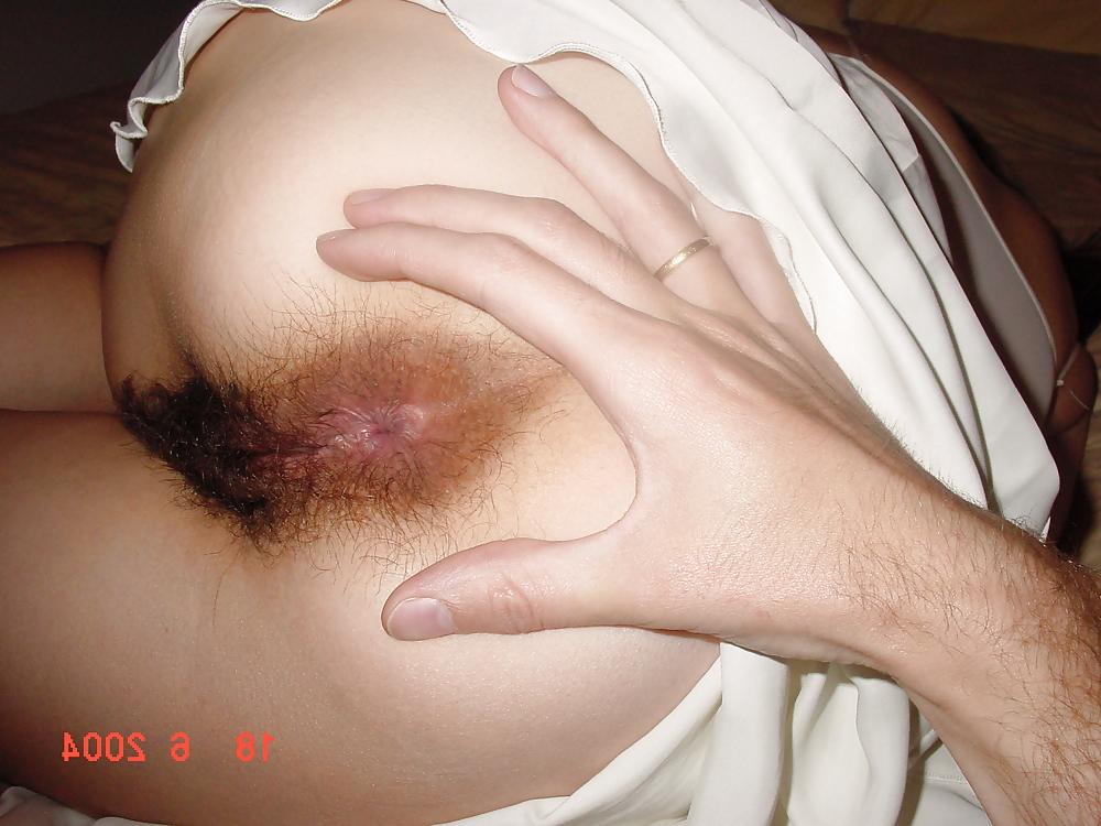 25P Hairy Ass Anus Anal