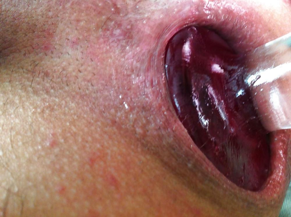 9P Anal games with plugs - 1