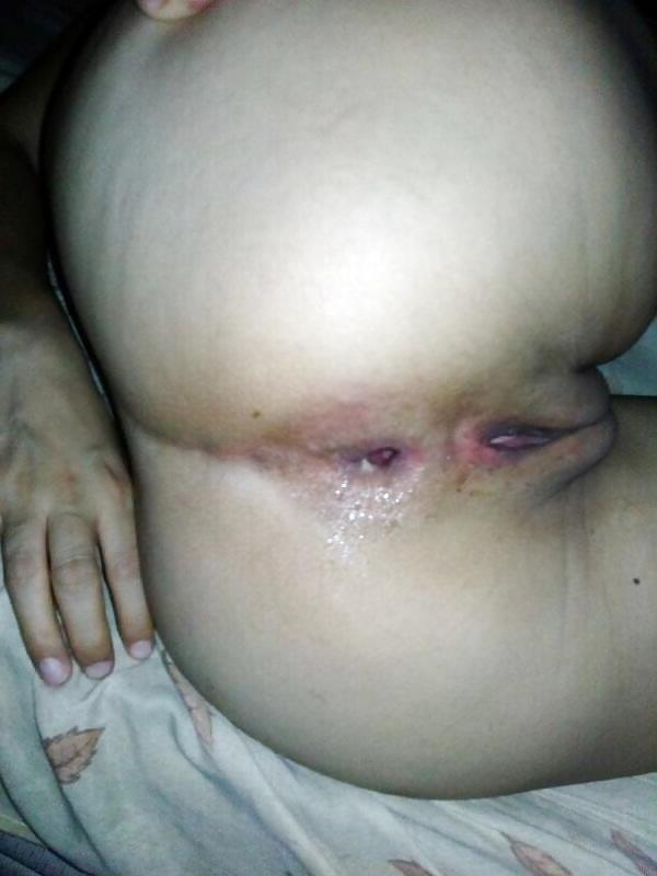 12P Crempie anal 