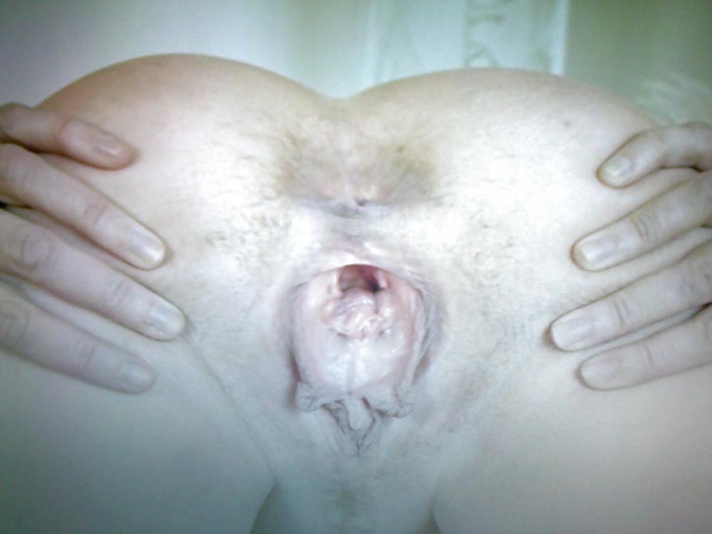 24P Womens anal before and after my swingers party