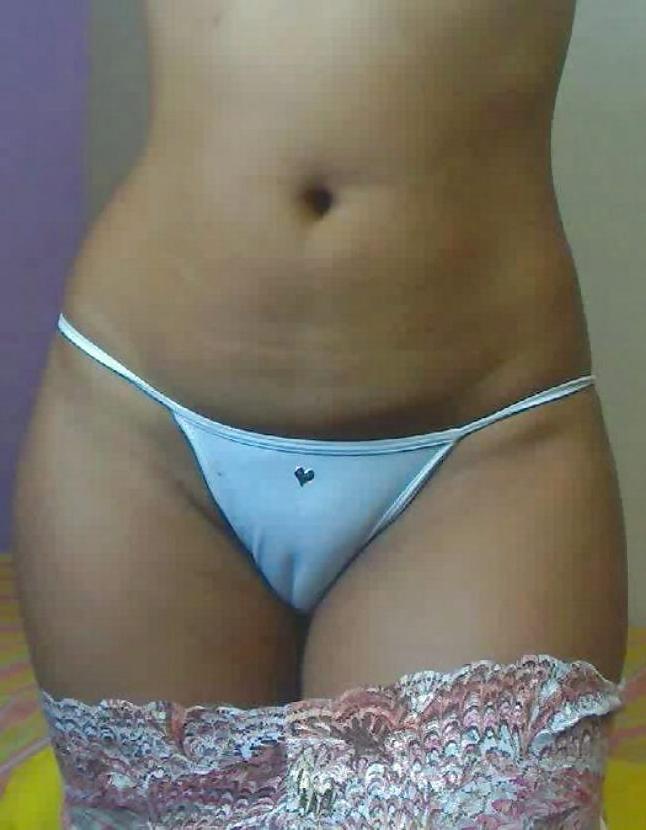 25P Amateur