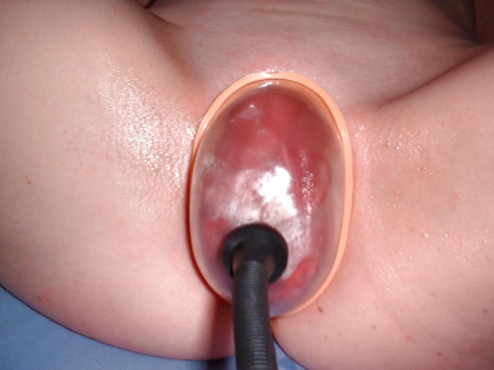25P My ex private devot bitch #2 (loves anal and fist)