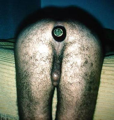 25P Anal insertion (male)