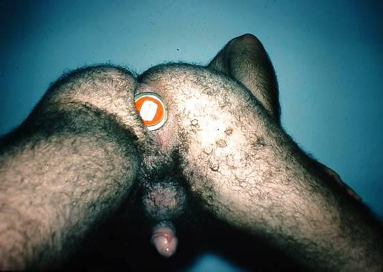 25P Anal insertion (male)