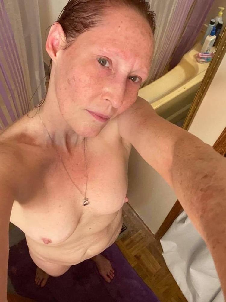 25P Cope