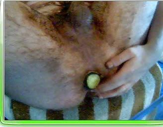 25P Anal