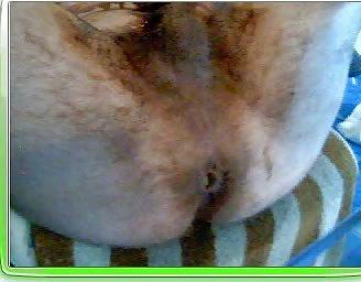 25P Anal