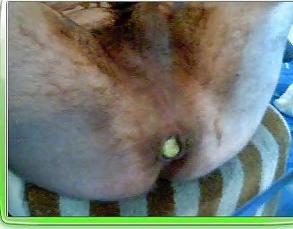 25P Anal