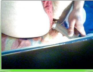 25P Anal
