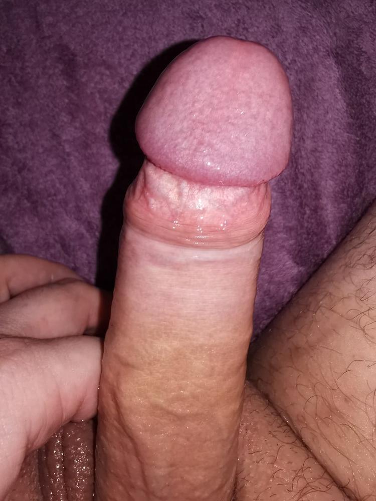 25P PICS