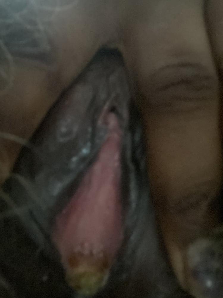 13P amateur