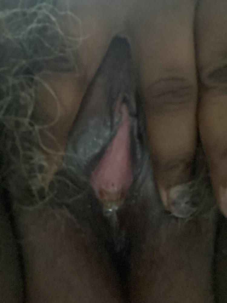 13P amateur
