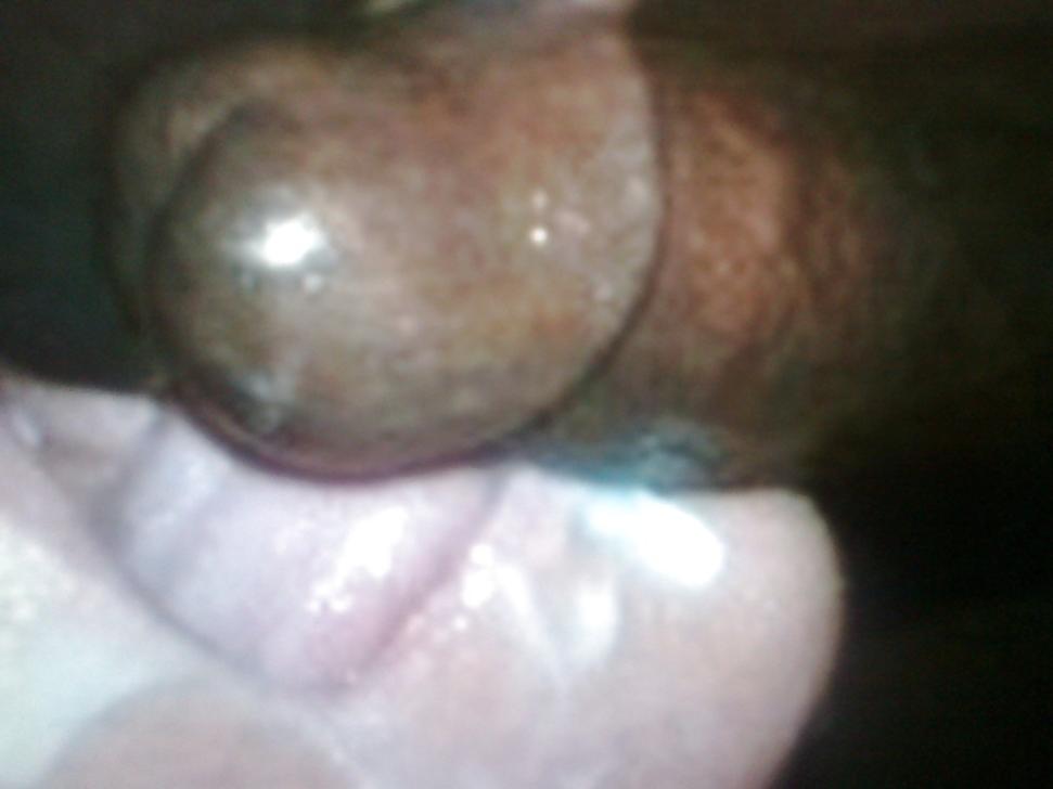 22P Weiße Frau benutzt