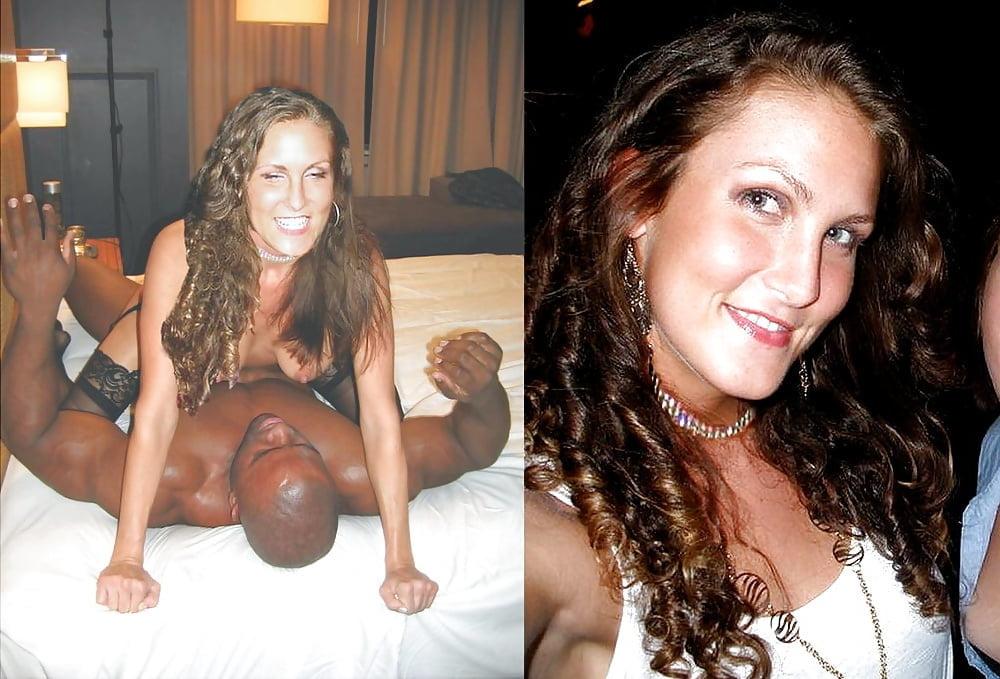 25P White Sluts  Before and After