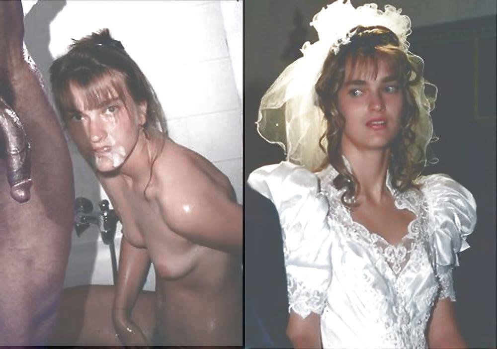 25P White Sluts  Before and After